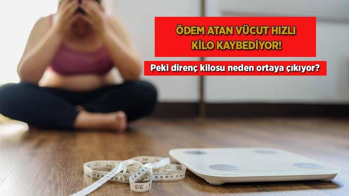 Ödem atan vücut hızlı kilo kaybediyor! Peki direnç kilosu neden ortaya çıkıyor?